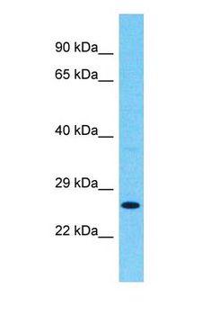 RCAN1 / DSCR1 Antibody - Western blot of RCAN1 Antibody with Fetal Kidney lysate.  This image was taken for the unconjugated form of this product. Other forms have not been tested.