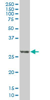 RCAN1 / DSCR1 Antibody - DSCR1 monoclonal antibody (M01A), clone 1G7. Western Blot analysis of DSCR1 expression in COLO 320 HSR.