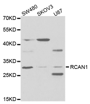 RCAN1 / DSCR1 Antibody - Western blot analysis of extracts of various cell lines, using RCAN1 antibody.