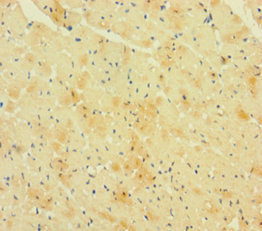 RCAN1 / DSCR1 Antibody - Immunohistochemistry of paraffin-embedded human heart tissue using RCAN1 Antibody at dilution of 1:100