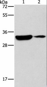 RCAN1 / DSCR1 Antibody - Western blot analysis of Mouse heart and brain tissue, using RCAN1 Polyclonal Antibody at dilution of 1:500.