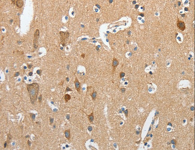 RCAN1 / DSCR1 Antibody - Immunohistochemistry of paraffin-embedded Human brain using RCAN1 Polyclonal Antibody at dilution of 1:45.