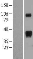 RCAN1 / DSCR1 Protein - Western validation with an anti-DDK antibody * L: Control HEK293 lysate R: Over-expression lysate