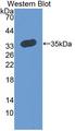 RCAN2 / RCN2 Antibody - Western blot of RCAN2 / RCN2 antibody.