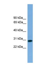 RCAN2 / RCN2 Antibody - RCAN2 antibody Western blot of THP-1 cell lysate. This image was taken for the unconjugated form of this product. Other forms have not been tested.