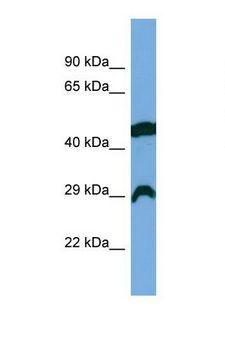 RCAN2 / RCN2 Antibody - Western blot of Human COLO205. RCAN2 antibody dilution 1.0 ug/ml.  This image was taken for the unconjugated form of this product. Other forms have not been tested.