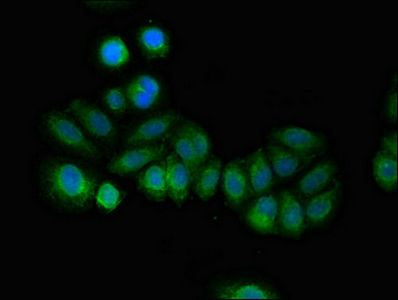 RCAN2 / RCN2 Antibody - Immunofluorescent analysis of A549 cells diluted at 1:100 and Alexa Fluor 488-congugated AffiniPure Goat Anti-Rabbit IgG(H+L)