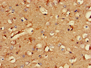 RCAN2 / RCN2 Antibody - Immunohistochemistry of paraffin-embedded human brain tissue at dilution of 1:100