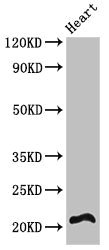 RCAN2 / RCN2 Antibody - Western Blot Positive WB detected in:Mouse heart tissue All Lanes:RCAN2 antibody at 3µg/ml Secondary Goat polyclonal to rabbit IgG at 1/50000 dilution Predicted band size: 22,28 KDa Observed band size: 22 KDa