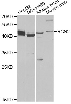 RCAN2 / RCN2 Antibody - Western blot analysis of extracts of various cell lines, using RCN2 antibody at 1:1000 dilution. The secondary antibody used was an HRP Goat Anti-Rabbit IgG (H+L) at 1:10000 dilution. Lysates were loaded 25ug per lane and 3% nonfat dry milk in TBST was used for blocking. An ECL Kit was used for detection and the exposure time was 10s.