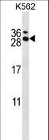 RCAN3 / Calcipressin 3 Antibody - RCAN3 Antibody western blot of K562 cell line lysates (35 ug/lane). The RCAN3 antibody detected the RCAN3 protein (arrow).