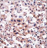 RCAN3 / Calcipressin 3 Antibody - RCAN3 Antibody immunohistochemistry of formalin-fixed and paraffin-embedded human liver tissue followed by peroxidase-conjugated secondary antibody and DAB staining.