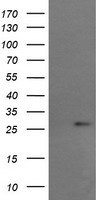 RCAN3 / Calcipressin 3 Antibody - HEK293T cells were transfected with the pCMV6-ENTRY control (Left lane) or pCMV6-ENTRY RCAN3 (Right lane) cDNA for 48 hrs and lysed. Equivalent amounts of cell lysates (5 ug per lane) were separated by SDS-PAGE and immunoblotted with anti-RCAN3.