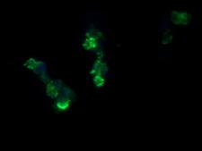 RCAN3 / Calcipressin 3 Antibody - Anti-RCAN3 mouse monoclonal antibody immunofluorescent staining of COS7 cells transiently transfected by pCMV6-ENTRY RCAN3.