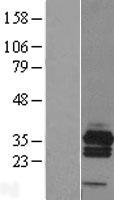 RCAN3 / Calcipressin 3 Protein - Western validation with an anti-DDK antibody * L: Control HEK293 lysate R: Over-expression lysate