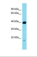 RCBTB1 Antibody - Western blot of Mouse Small Intestine. Rcbtb1 antibody dilution 1.0 ug/ml.  This image was taken for the unconjugated form of this product. Other forms have not been tested.