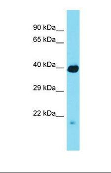 RCBTB1 Antibody - Western blot of Mouse Small Intestine. Rcbtb1 antibody dilution 1.0 ug/ml.  This image was taken for the unconjugated form of this product. Other forms have not been tested.