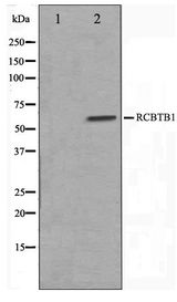 RCBTB1 Antibody - Western blot of LOVO cell lysate using RCBTB1 Antibody
