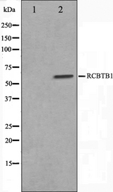 RCBTB1 Antibody - Western blot analysis on LOVO cells cell lysates using RCBTB1 antibody. The lane on the left is treated with the antigen-specific peptide.