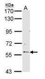 RCBTB2 Antibody - Sample (30 ug of whole cell lysate). A: Hep G2 . 7.5% SDS PAGE. RCBTB2 antibody diluted at 1:1000.