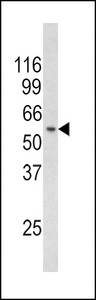 RCBTB2 Antibody - Western blot of CHC1L Antibody in mouse thymus tissue lysates (35 ug/lane). CHC1L (arrow) was detected using the purified antibody.