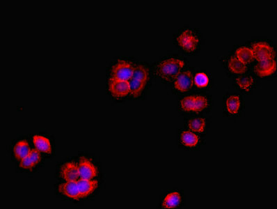 RCBTB2 Antibody - Immunofluorescent analysis of PC-3 cells using RCBTB2 Antibody at dilution of 1:100 and Cy3-congugated Goat Anti-Rabbit IgG