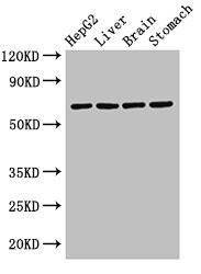 RCBTB2 Antibody - Western Blot Positive WB detected in: HepG2 whole cell lysate, Rat liver tissue, Rat brain tissue, Rat stomach tissue All lanes: RCBTB2 antibody at 3.2µg/ml Secondary Goat polyclonal to rabbit IgG at 1/50000 dilution Predicted band size: 61, 58 kDa Observed band size: 61 kDa