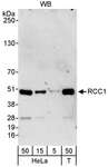RCC1 Antibody - Detection of Human RCC1 by Western Blot of Whole Cell Lysate. Samples: Whole cell lysate from HeLa (5, 15 and 50 ug) and 293T (T; 50 ug) cells. Antibodies: Affinity purified goat anti-RCC1 antibody BL1972G used for WB at 0.1 ug/ml. Detection: Chemiluminescence with an exposure time of 3 minutes.