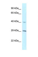 RCC1 Antibody - RCC1 antibody Western blot of H226 Cell lysate. Antibody concentration 1 ug/ml.  This image was taken for the unconjugated form of this product. Other forms have not been tested.