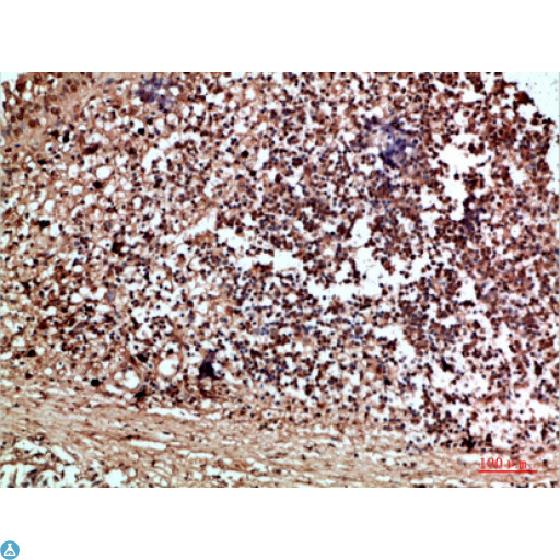 RCC1 Antibody - Immunohistochemical analysis of paraffin-embedded human-thyroid, antibody was diluted at 1:200.