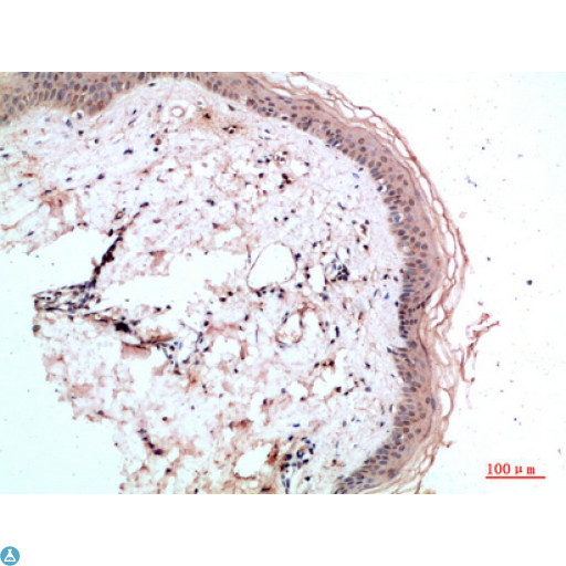 RCC1 Antibody - Immunohistochemical analysis of paraffin-embedded human-skin, antibody was diluted at 1:200.