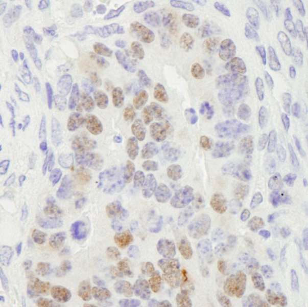 RCC2 Antibody - Detection of Mouse RCC2 by Immunohistochemistry. Sample: FFPE section of mouse teratoma. Antibody: Affinity purified rabbit anti-RCC2 used at a dilution of 1:100.