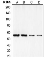 RCC2 Antibody - Western blot analysis of RCC2 expression in HeLa (A); A549 (B); MOLT4 (C); NIH3T3 (D) whole cell lysates.