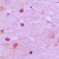 RCC2 Antibody - Immunohistochemical analysis of RCC2 staining in human brain formalin fixed paraffin embedded tissue section. The section was pre-treated using heat mediated antigen retrieval with sodium citrate buffer (pH 6.0). The section was then incubated with the antibody at room temperature and detected using an HRP conjugated compact polymer system. DAB was used as the chromogen. The section was then counterstained with hematoxylin and mounted with DPX.