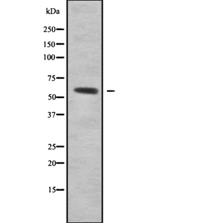 RCC2 Antibody - Western blot analysis of RCC2 using HepG2 whole cells lysates