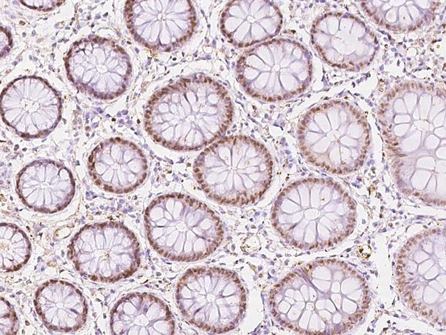 RCC2 Antibody - Immunochemical staining of human RCC2 in human colon with rabbit polyclonal antibody at 1:100 dilution, formalin-fixed paraffin embedded sections.