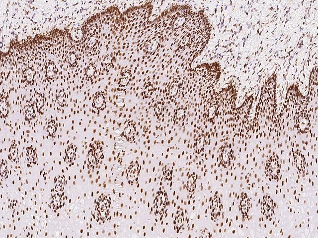 RCC2 Antibody - Immunochemical staining of human RCC2 in human esophagus with rabbit polyclonal antibody at 1:100 dilution, formalin-fixed paraffin embedded sections.