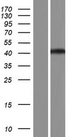 RCCD1 Protein - Western validation with an anti-DDK antibody * L: Control HEK293 lysate R: Over-expression lysate