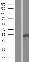 RCD1 / RQCD1 Protein - Western validation with an anti-DDK antibody * L: Control HEK293 lysate R: Over-expression lysate