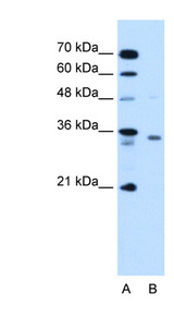 RCE1 Antibody - RCE1 antibody ARP44797_T100-NP_005124-RCE1(RCE1 homolog, prenyl protein peptidase (S. cerevisiae)) Antibody Western blot of HepG2 cell lysate.  This image was taken for the unconjugated form of this product. Other forms have not been tested.