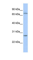 RCHY1 / PIRH2 Antibody - RCHY1 / PIRH2 antibody Western blot of Jurkat lysate. This image was taken for the unconjugated form of this product. Other forms have not been tested.