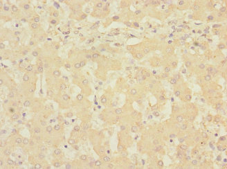 RCHY1 / PIRH2 Antibody - Immunohistochemistry of paraffin-embedded human liver tissue at dilution 1:100