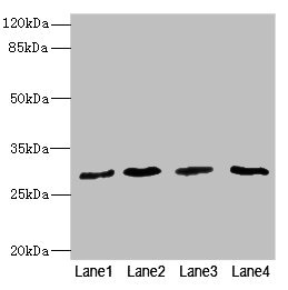 RCHY1 / PIRH2 Antibody - Western blot All Lanes: KLHL13 antibody at 3.98ug/ml Lane 1: SH-SY5Y whole cell lysate Lane 2: 293T whole cell lysate Lane 3: MCF7 whole cell lysate Lane 4: Hela whole cell lysate Secondary Goat polyclonal to rabbit IgG at 1/10000 dilution Predicted band size: 31,29,21,22,9,28,26,25 kDa Observed band size: 30 kDa