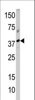 RCL1 Antibody - Western blot of anti-RCL1 antibody in A375 cell line lysate (35 ug/lane). RCL1(arrow) was detected using the purified antibody.