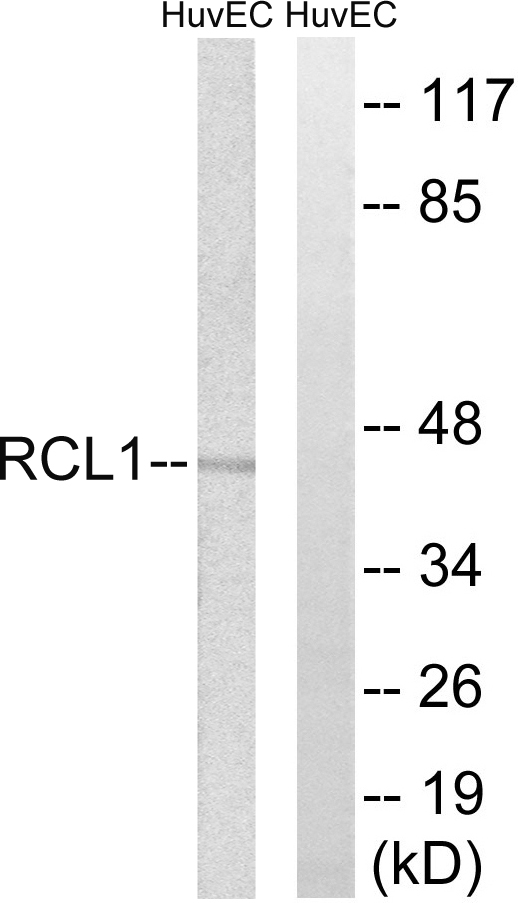 RCL1 Antibody - Western blot analysis of lysates from HUVEC cells, using RCL1 Antibody. The lane on the right is blocked with the synthesized peptide.