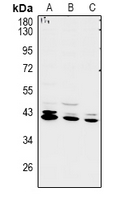 RCL1 Antibody - Western blot analysis of RCL1 expression in LO2 (A), A549 (B), COS7 (C) whole cell lysates.