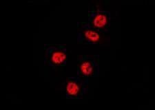 RCL1 Antibody - Staining MCF-7 cells by IF/ICC. The samples were fixed with PFA and permeabilized in 0.1% Triton X-100, then blocked in 10% serum for 45 min at 25°C. The primary antibody was diluted at 1:200 and incubated with the sample for 1 hour at 37°C. An Alexa Fluor 594 conjugated goat anti-rabbit IgG (H+L) Ab, diluted at 1/600, was used as the secondary antibody.