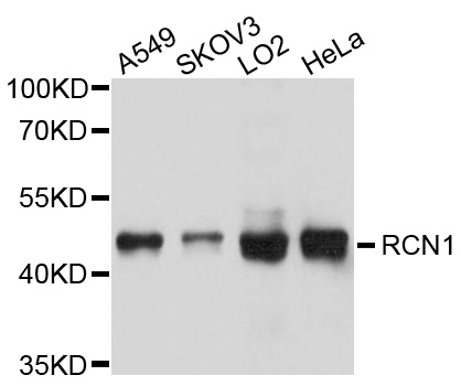 RCN1 / Reticulocalbin 1 Antibody - Western blot analysis of extracts of various cell lines, using RCN1 antibody at 1:1000 dilution. The secondary antibody used was an HRP Goat Anti-Rabbit IgG (H+L) at 1:10000 dilution. Lysates were loaded 25ug per lane and 3% nonfat dry milk in TBST was used for blocking. An ECL Kit was used for detection and the exposure time was 1s.