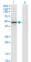 RCN2 Antibody - Western blot of RCN2 expression in transfected 293T cell line by RCN2 monoclonal antibody (M02), clone 1A9.
