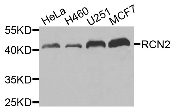 RCN2 Antibody - Western blot analysis of extracts of various cells.